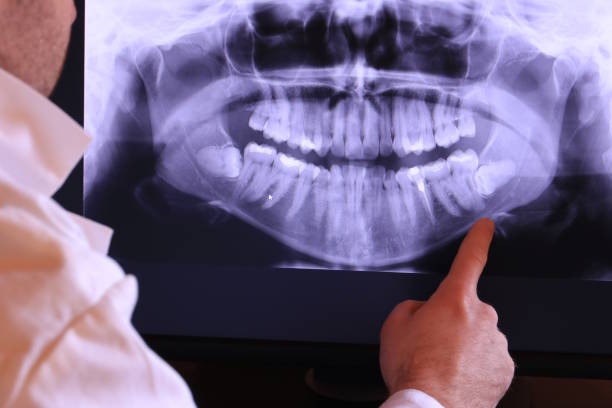 Best Orthodontic Emergency Dentist in Wona Lake, IN