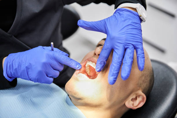 Best Emergency Dentist for Knocked-Out Tooth in Wona Lake, IN